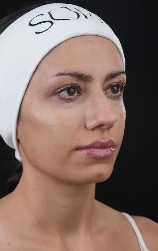 After Biosome Bright facial balance treatment result