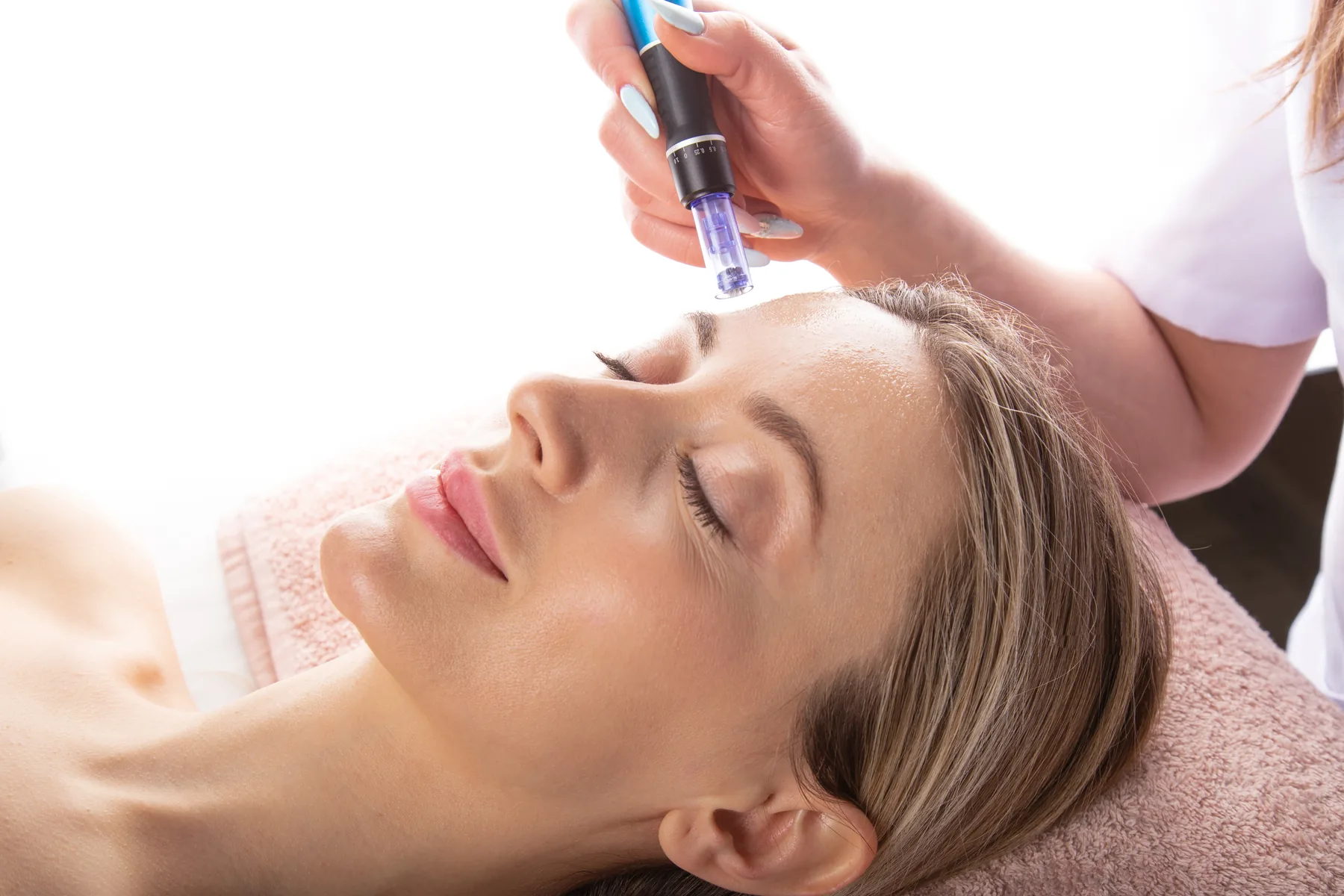 SkinPen Precision Microneedling