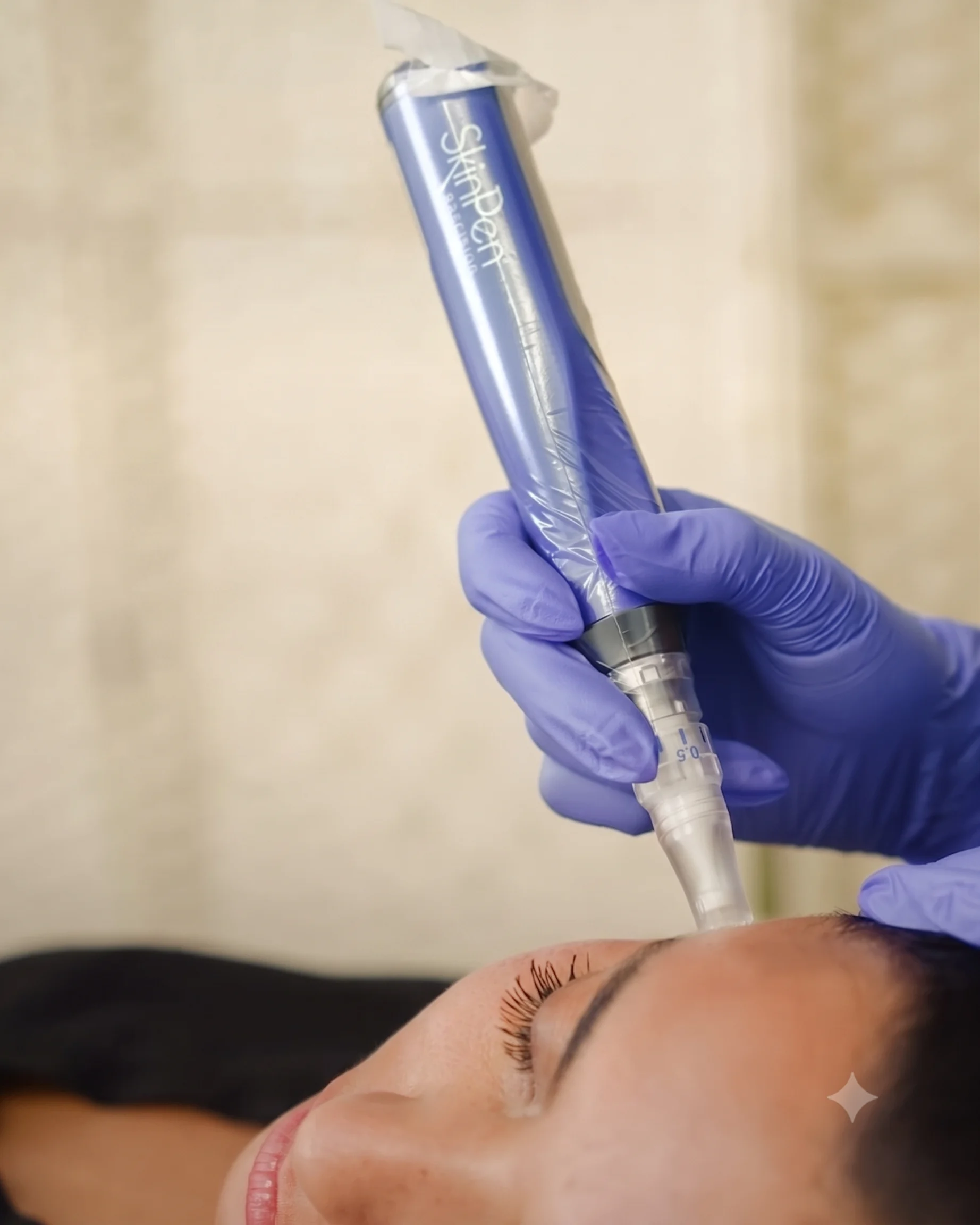 SkinPen Precision microneedling treatment using the SkinPen device at SOLAÉ Dubai