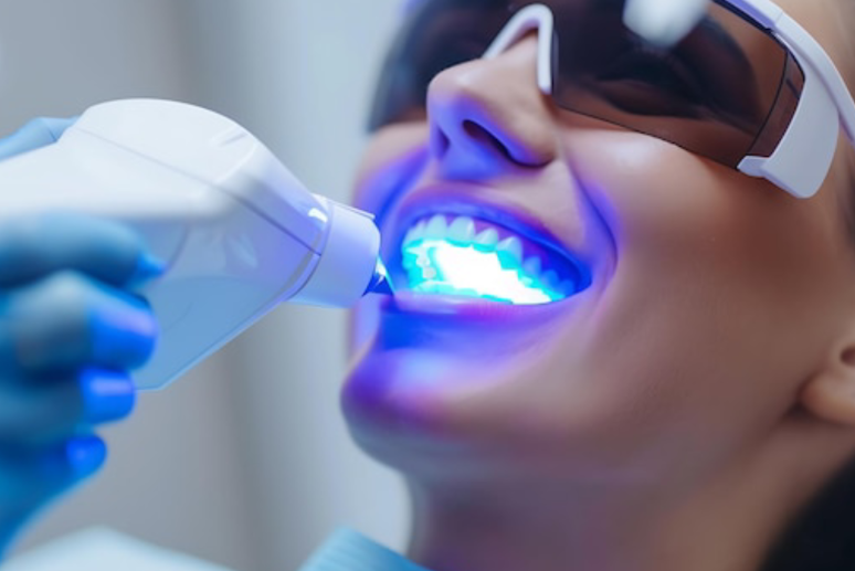 Laser Dentistry